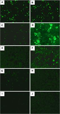 Effect of Clozapine on Anti-N-Methyl-D-Aspartate Receptor Encephalitis With Psychiatric Symptoms: A Series of Three Cases